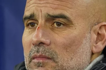 Football : Guardiola revient sur sa boutade après sa cicatrice au nez